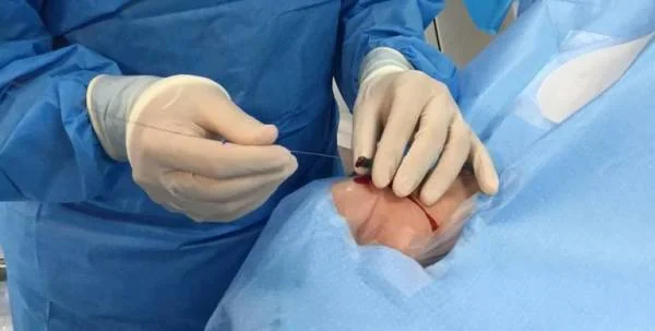 آنژیوگرافی از دست 