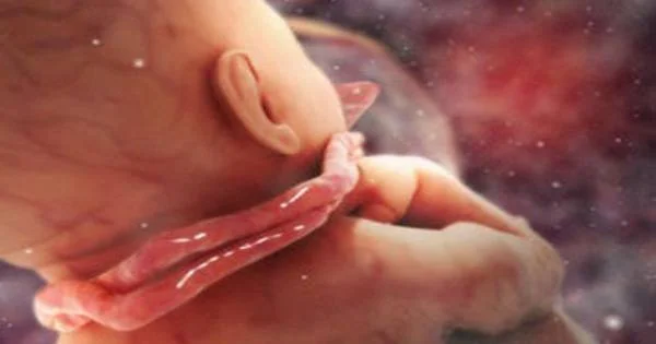 علائم جنین مرده