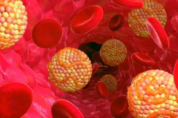 سطح بالای کلسترول 