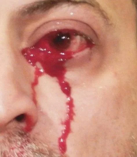 خون گریه کردن
