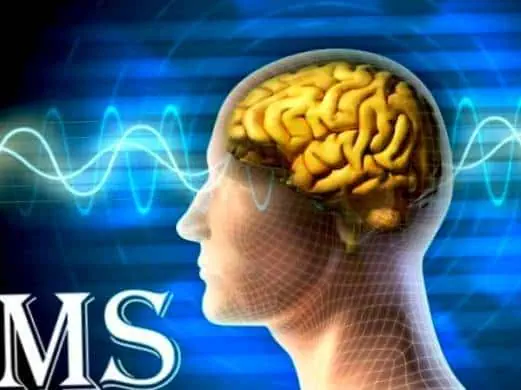 علائم بیماری ام اس