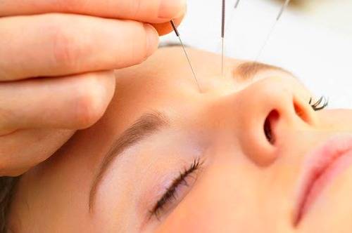 درمان سردرد