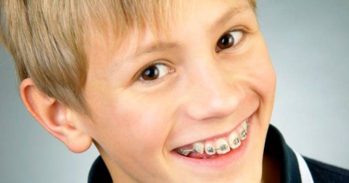 سن ارتودنسی دندان کودک
