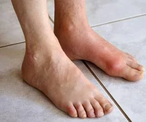 تشخیص بیماری از پا