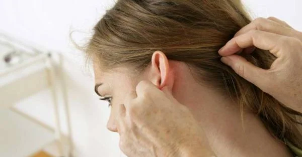 بوی بد پشت گوش