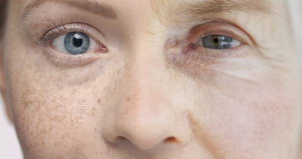 راه درمان ملاسما