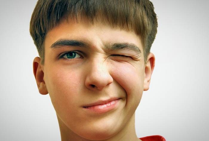 تیک عصبی چشم 