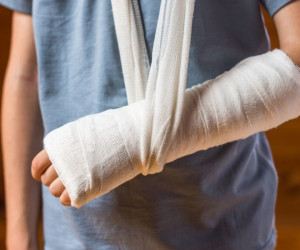 تغذیه شکستگی استخوان