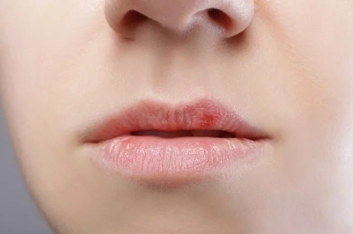 زیادی نمک بدن