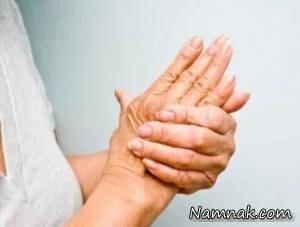 آرتریت روماتوئید