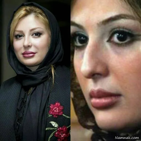 نیوشا ضیغمی