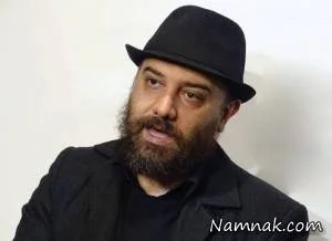 کاشت مو