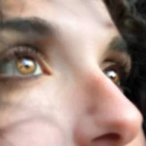 جراحی بینی