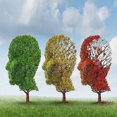 آلزایمر