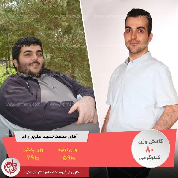 محمدحمید علوی راد   قهرمان رژیم لاغری دکتر کرمانی
