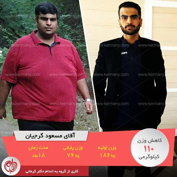 مسعود گرجیان   قهرمان رژیم لاغری دکتر کرمانی