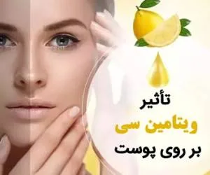 ویتامین سی