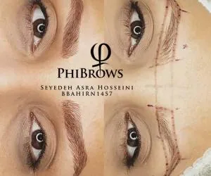 فیبروز ابرو