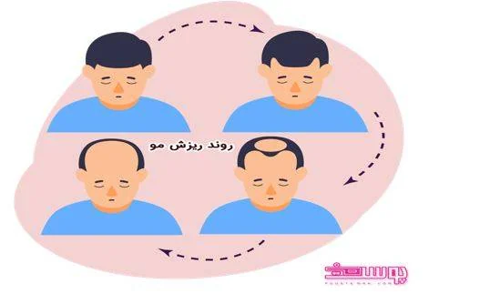 رویش مو