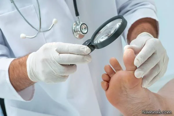 جراحی زخم پای دیابتی 