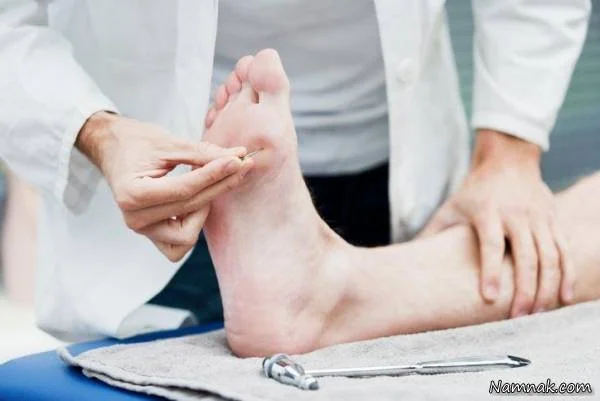 علت زخم پای دیابتی