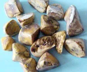 کیسه صفرا