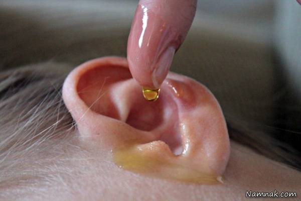 درمان گیاهی گوش درد