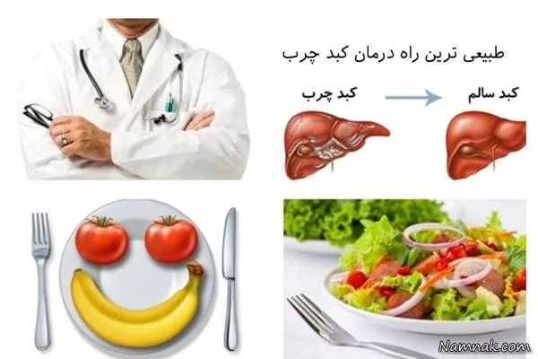 پیشگیری و درمان کبد چرب