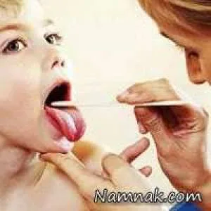بزرگی لوزه سوم