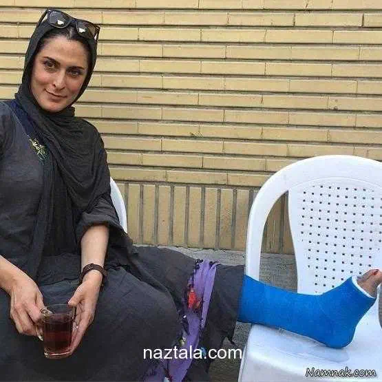 بهناز جعفری با پای شکسته
