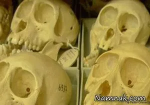 جراحی جمجمه