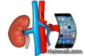 فروش کلیه