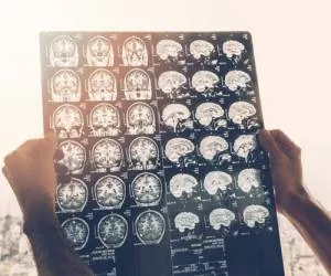 متخصص نورولوژی