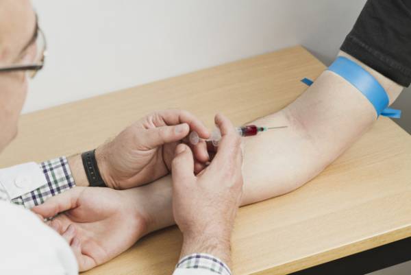 Artritis reumatoide de la mano Diagnóstico de reumatismo articular