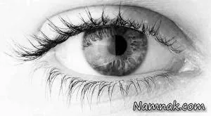 سلامت چشم