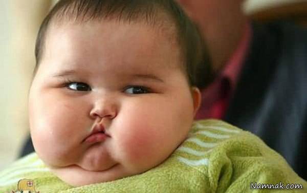 چاقی نوزاد