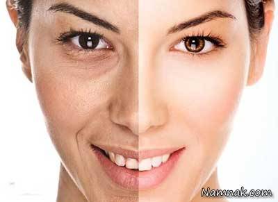 تاثیر استرس بر بدن