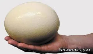 سنگ مثانه