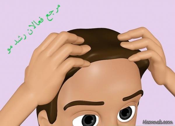 درمان ریزش مو
