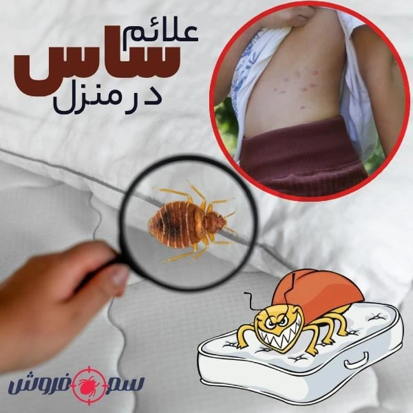 علائم ساس در منزل