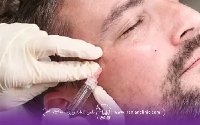 مردی که چشمان خود را بسته و دستان دکتری که در حال تزریق پروفایلو میباشد