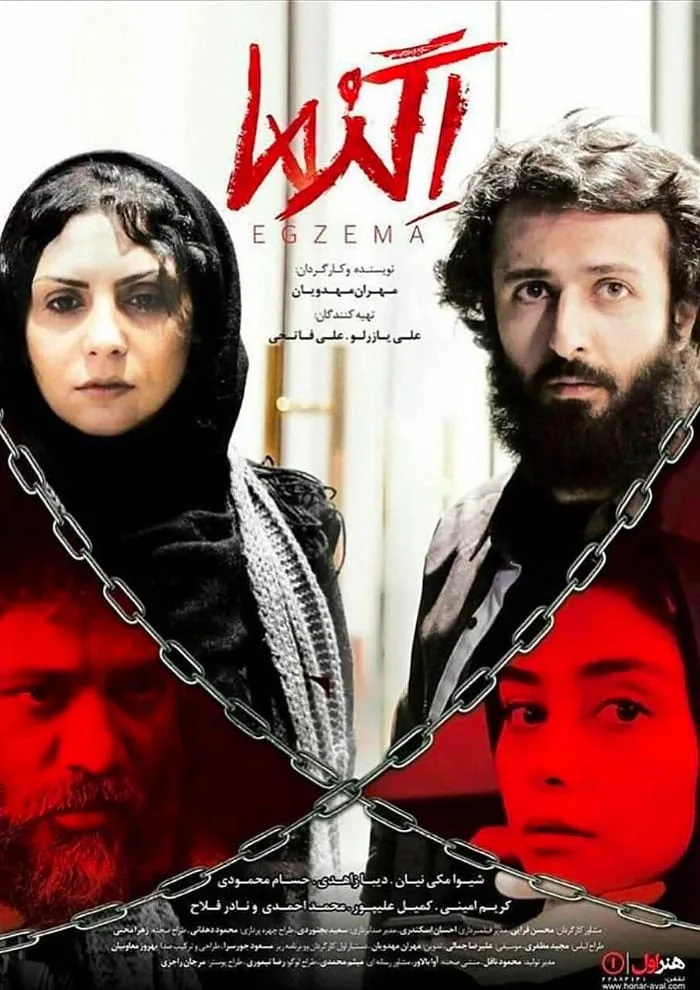 شیوا مکینیان در اگزما