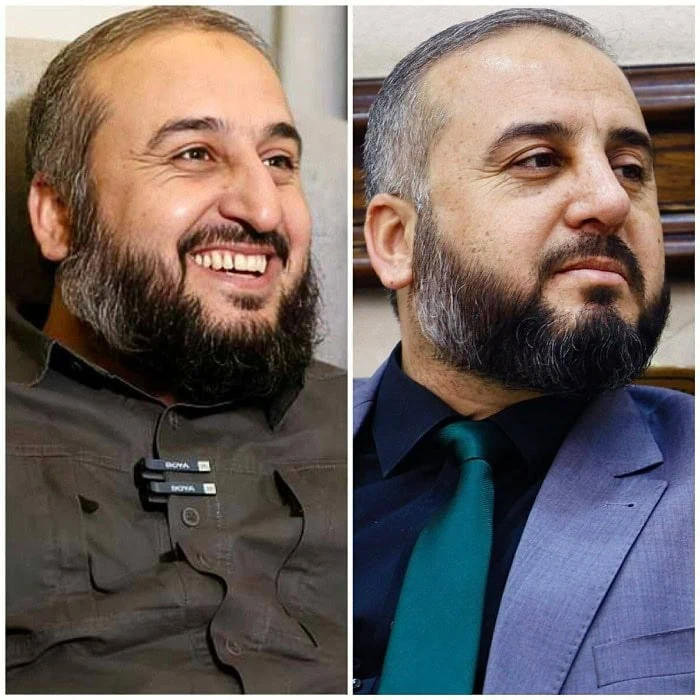 جراحی بینی
