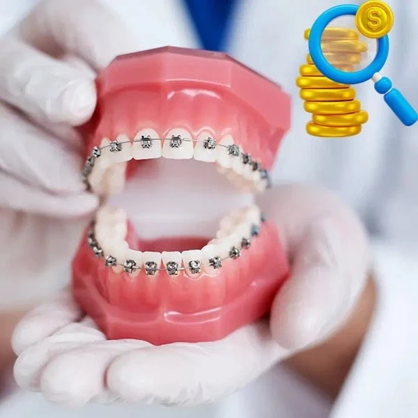 عوامل موثر بر قیمت ارتودنسی دندان