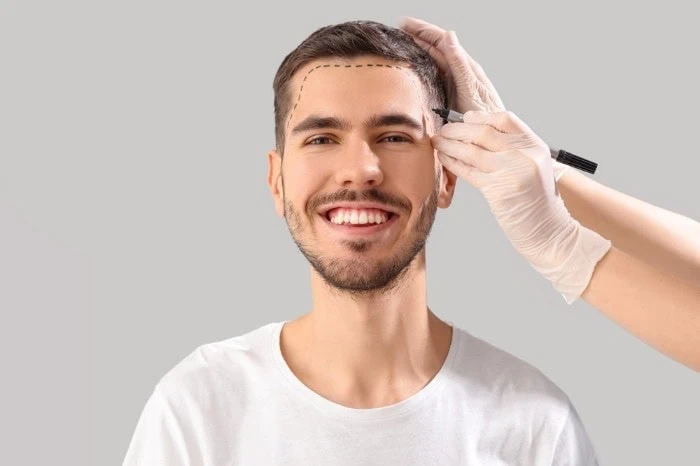 Essential tips for men preparing for a Hair transplant in Turkey | Este Medical