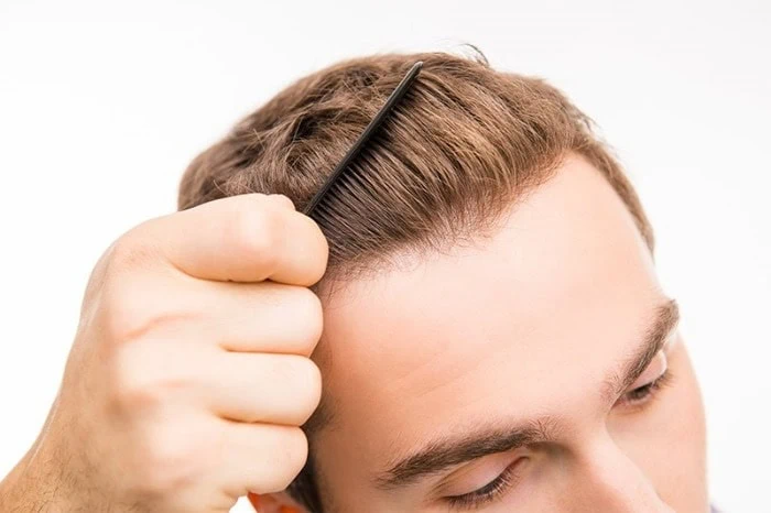 Why have an FUE Hair Transplant   Paras Hair Transplant