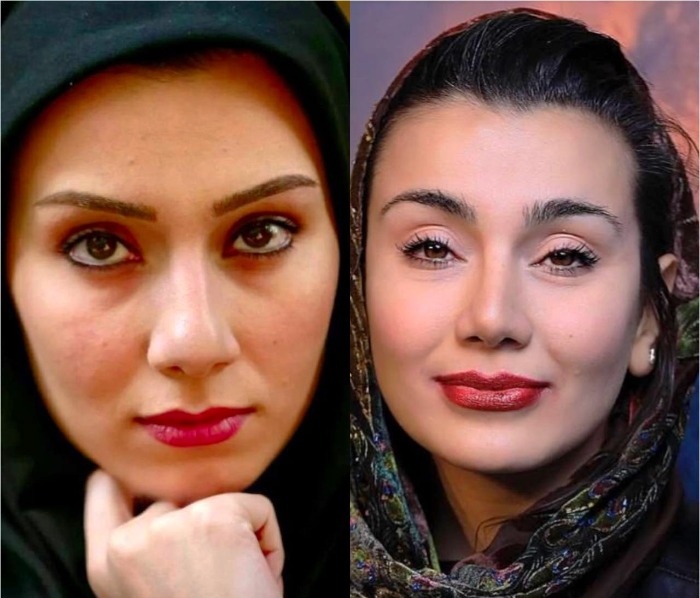 خاطره حاتمی قبل عمل