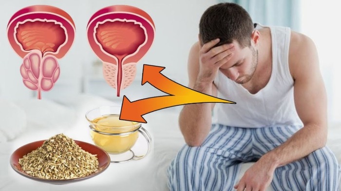 برای درمان پروستات چه بخوریم؟ بررسی جامع بایدها و نبایدها