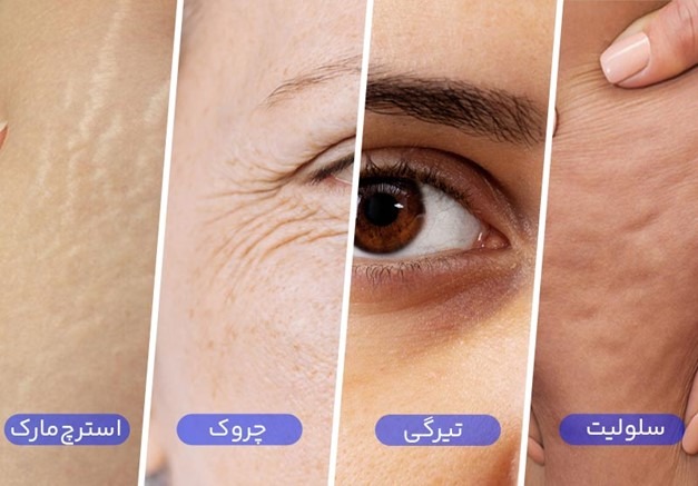 جوانسازی پوست