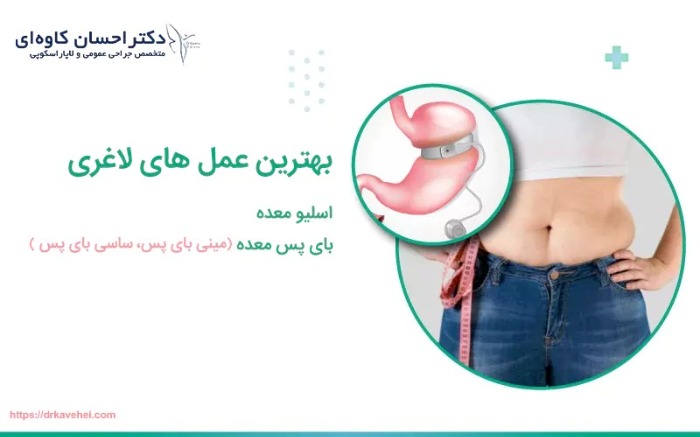 روش های مطمئن برای لاغری